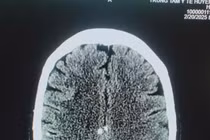 Chi chít sán từ chân tới não vì... sở thích ăn đồ sống