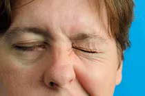 Bị liệt dây thần kinh số 7 có thể chữa khỏi không?