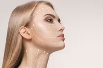 Cách cấy chỉ làm đẹp an toàn, không gây biến chứng