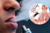 Địa chỉ vàng: Thực phẩm chức năng hỗ trợ bỏ thuốc lá