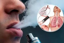 Địa chỉ vàng: Thực phẩm chức năng hỗ trợ bỏ thuốc lá