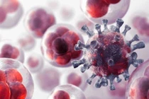 Điều trị ung thư không cần thuốc, không xâm lấn