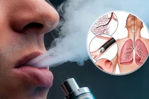 Thử "làm người lớn", nhiều học sinh nguy kịch vì thuốc lá điện tử