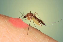 Địa chỉ vàng: Các bệnh viện cấp cứu sốt xuất huyết thể nặng