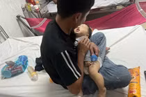 Xác minh vụ việc cháu bé 9 tháng tuổi bị bầm tím 2 má