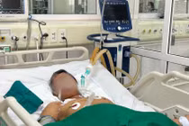 Hà Nội có 3 người tử vong do uốn ván