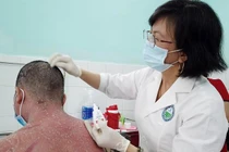 Trị vẩy nến bằng Đông y: Loạn sản phẩm, công dụng