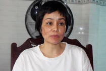 Thai phụ Kiên Giang tố chồng bạo hành: Có căn cứ để khởi tố vụ án?