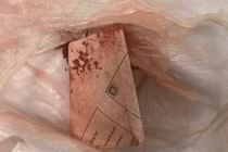 Dùng "thuốc cam" rơ lưỡi, bé trai 1 tuổi bị nhiễm chì nặng trong máu