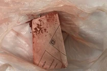 Dùng "thuốc cam" rơ lưỡi, bé trai 1 tuổi bị nhiễm chì nặng trong máu