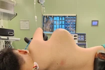 Phẫu thuật thành công cho cậu bé mang khối u “khủng” hiếm gặp