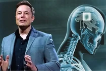 Công ty của tỷ phú Elon Musk chuẩn bị thử nghiệm gắn chip vào não người
