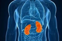  5 dấu hiệu ung thư thận không nên chủ quan