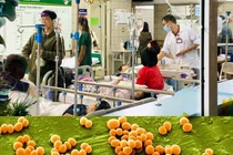 Ngộ độc do vi khuẩn tụ cầu vàng có nguy hiểm không?