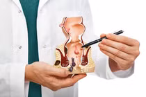 Bệnh trĩ gây biến chứng nguy hiểm thế nào?