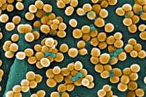 Nhiễm khuẩn tụ cầu vàng nguy hiểm ra sao?