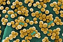 Nhiễm khuẩn tụ cầu vàng nguy hiểm ra sao?