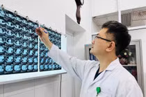 Cắt khối u giáp khổng lồ nằm sâu trong lồng ngực cụ bà 86 tuổi