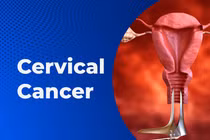 Ai dễ mắc ung thư cổ tử cung?