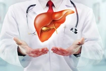 Bác sĩ chỉ cách phòng tránh bệnh về gan và ung thư gan