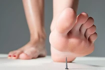 Tình trạng người bệnh bị uốn ván do giẫm phải chiếc đinh nhỏ rỉ đã ổn định sau điều trị