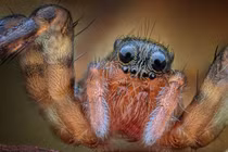 Sưng tấy ngón chân, đi khám phát hiện 'quái thú' ký sinh