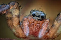 Sưng tấy ngón chân, đi khám phát hiện 'quái thú' ký sinh