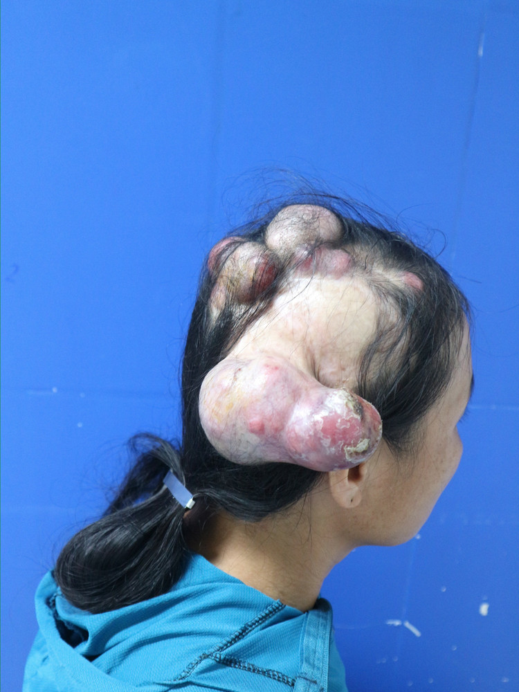 Can benh khien nguoi phu nu 