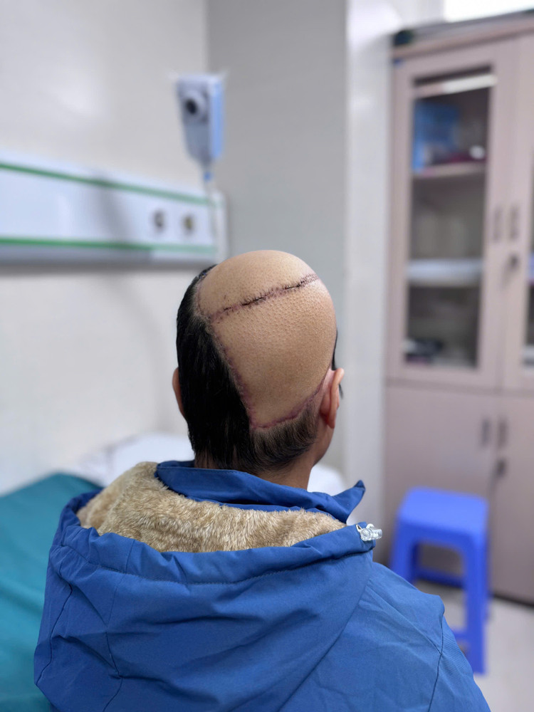 Can benh khien nguoi phu nu 