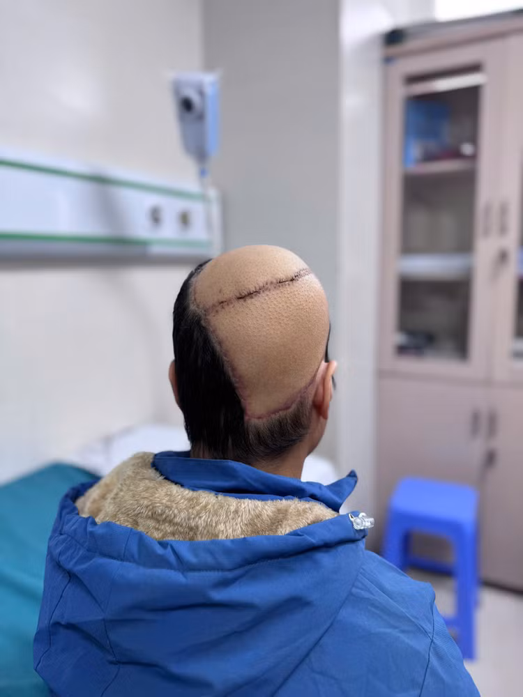 Can benh khien nguoi phu nu 