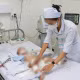 Cứu sống bệnh nhi mắc tay chân miệng nguy kịch ở Khánh Hoà