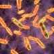 Vụ ngộ độc bánh mì ở Đồng Tháp: 290 ca mắc liên quan đến Salmonella