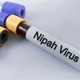 Tăng cường bảo đảm an toàn thực phẩm trong phòng, chống bệnh do virus Nipah