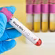 WHO cảnh báo tăng ca nhiễm virus Tây sông Nile ở châu Âu