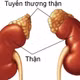 Suy tuyến thượng thận là tình trạng rối loạn trao đổi chất ở thận. Ảnh minh họa/Nguồn Internet