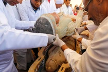 Tục trám răng có từ thời Ai Cập cổ đại 