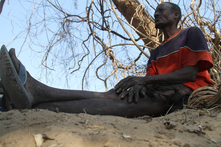 Bi an bo toc “nguoi da dieu