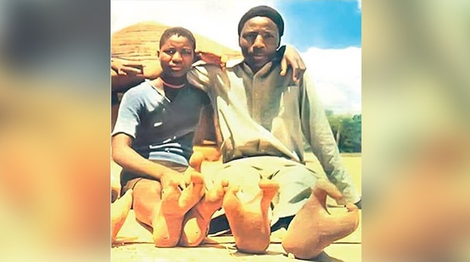 Bi an bo toc “nguoi da dieu