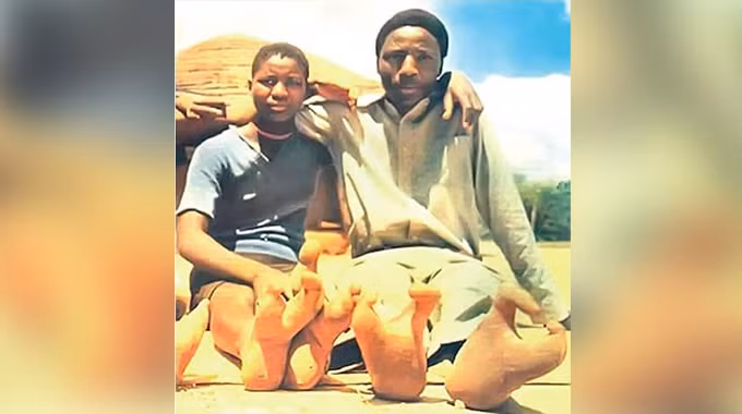 Bi an bo toc “nguoi da dieu