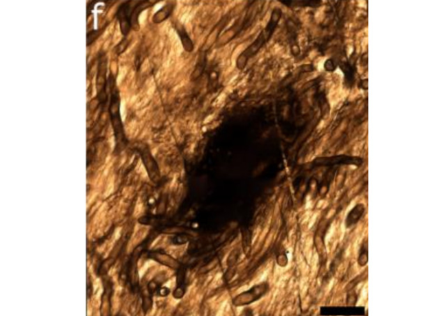 Su that chan dong ve “quai vat” khong chan tay cao 8m-Hinh-3