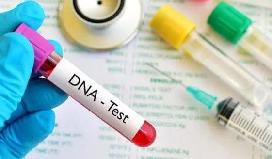 Chồng lén lấy tóc của con đi xét nghiệm ADN làm tôi ngã quỵ Chong len lay toc cua con di xet nghiem ADN lam toi nga quy