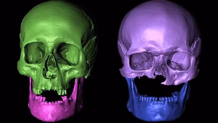 Mo mo co thoi Trung co, chuyen gia lay bay vi thay thu nay-Hinh-3