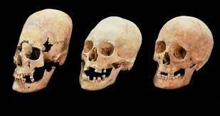 Noi da ga ky thuat nan dai hop so cua nguoi La Ma co dai-Hinh-8