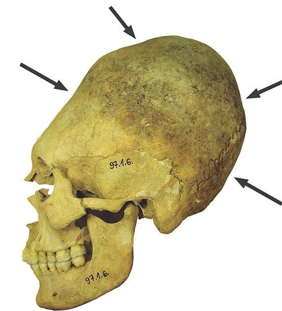Noi da ga ky thuat nan dai hop so cua nguoi La Ma co dai-Hinh-5