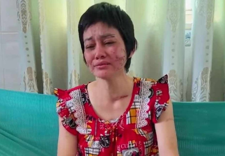 Cong an dang xac minh thai phu o Kien Giang to chong bao hanh