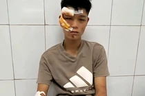 Khởi tố vụ án, điều tra tội giết người vụ tông trọng thương Đại úy CSCĐ