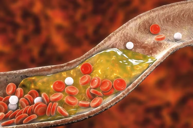 ho-tro-giam-cholesterol.jpg