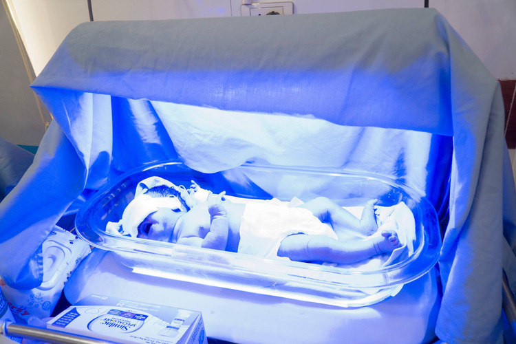 Chiếu đèn chữa vàng da sơ sinh - Ảnh BVCC