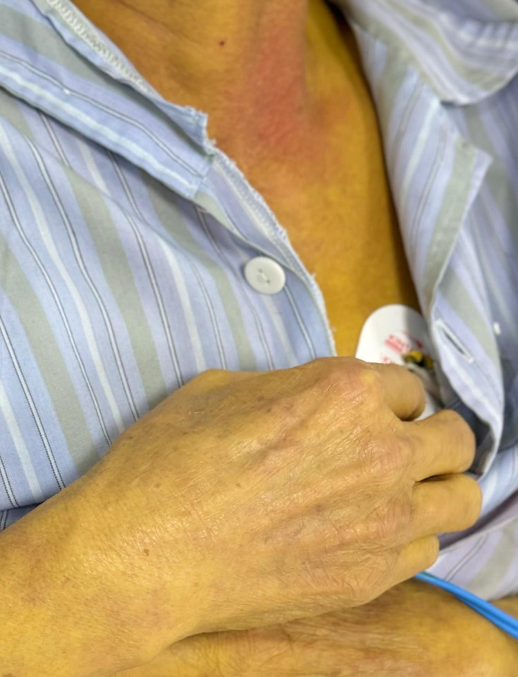 Men gan tăng gấp 35 lần do uống thuốc nam không rõ nguồn gốc - ảnh BVCC