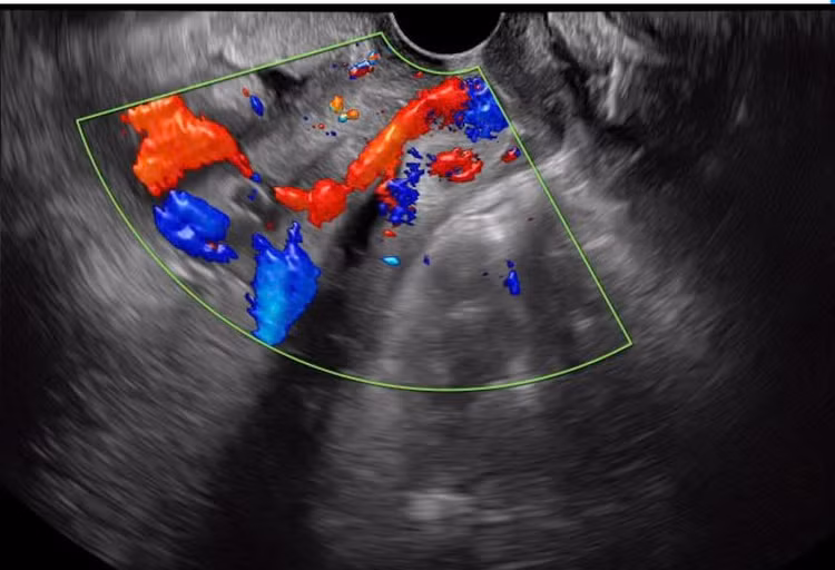 Cuộc chạy đua cấp cứu giành lại sự sống cho sản phụ mạch máu tiền đạo ảnh 1